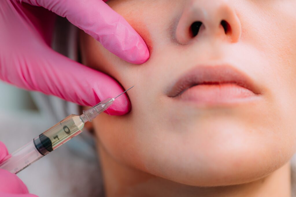 bichectomia o cirugía para mejillas