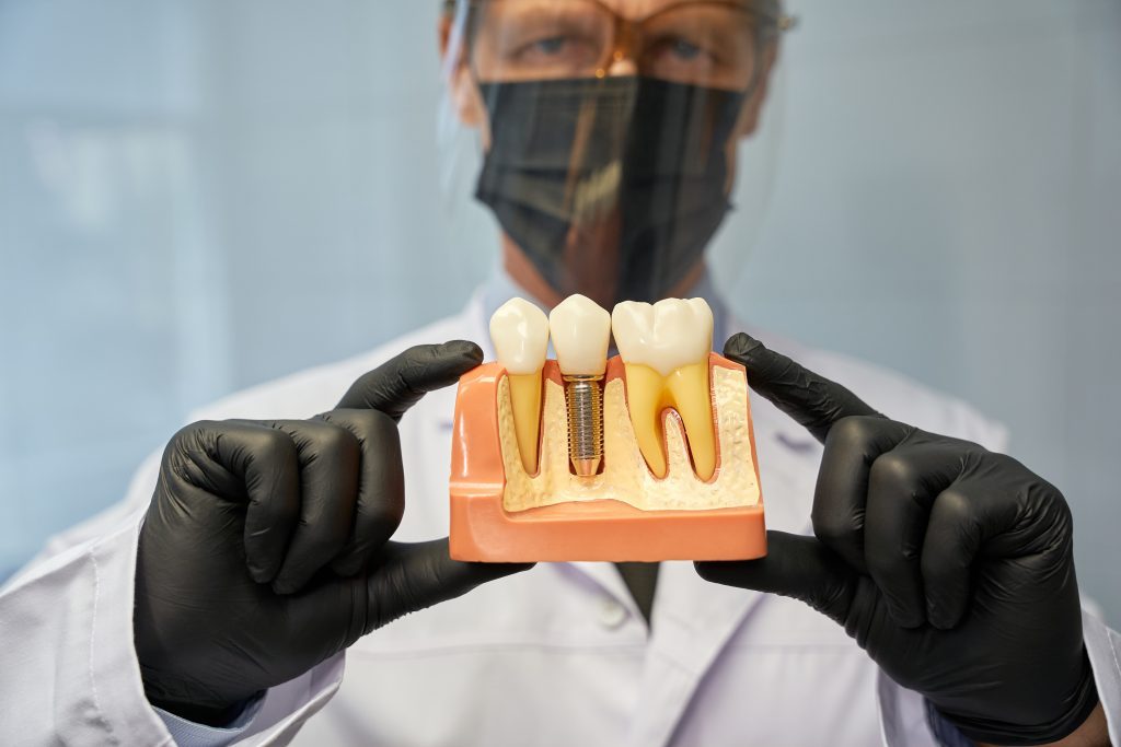 Implantes dentales en Colombia