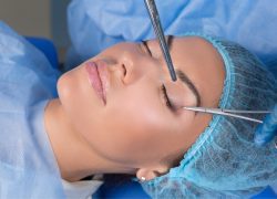 Blefaroplastia